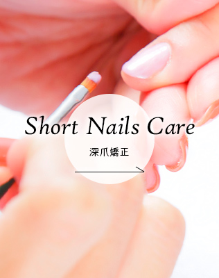 Nail Correction